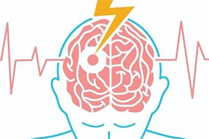 ISC23丨约五分之一的卒中幸存者发现心律失常，STROKE AF研究的最新结果再次强调了对卒中患者进行长期连续心脏监护的重要性