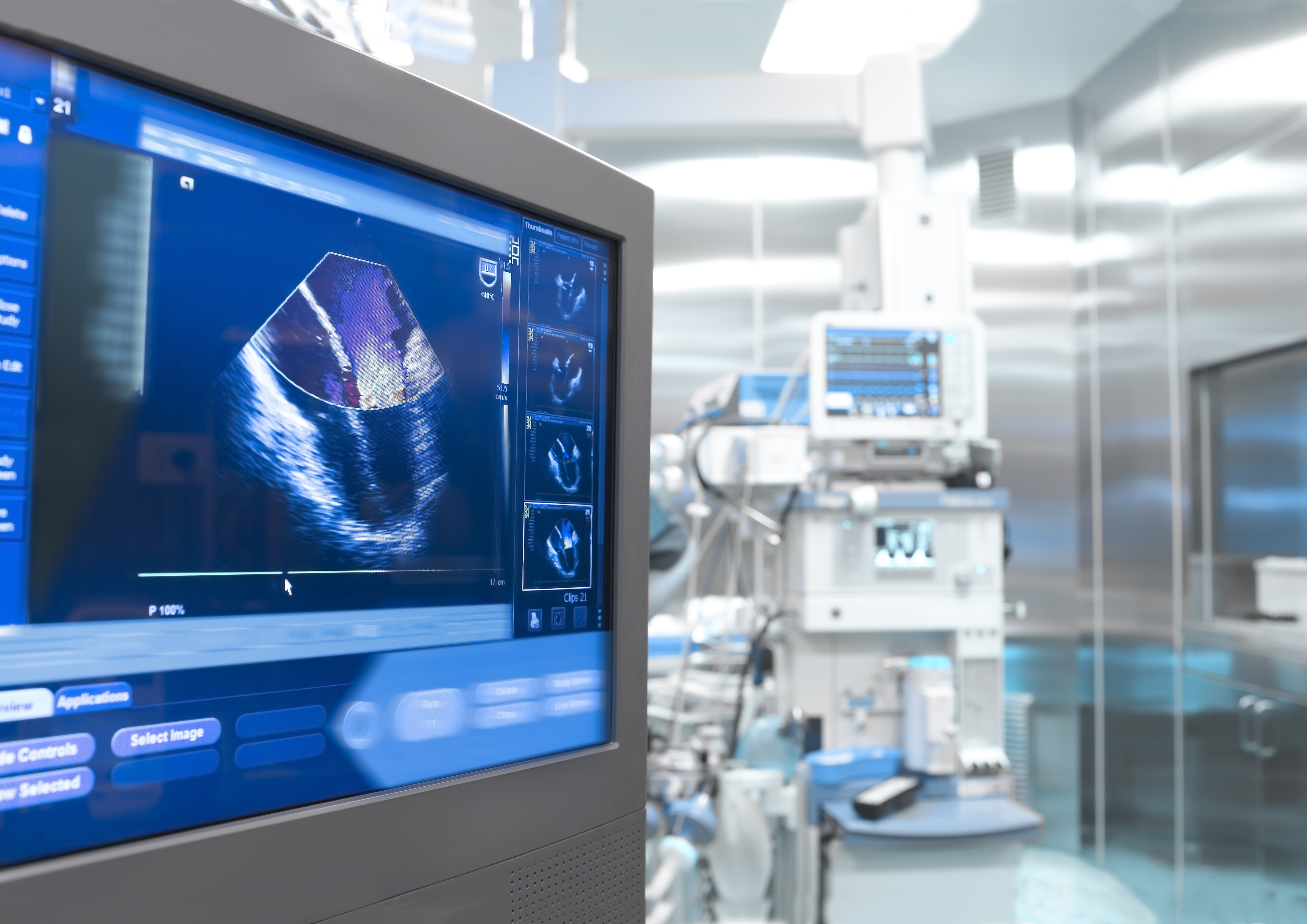 JAHA：二维超声心动图，如何鉴别A型急性主动脉夹层和STEMI？